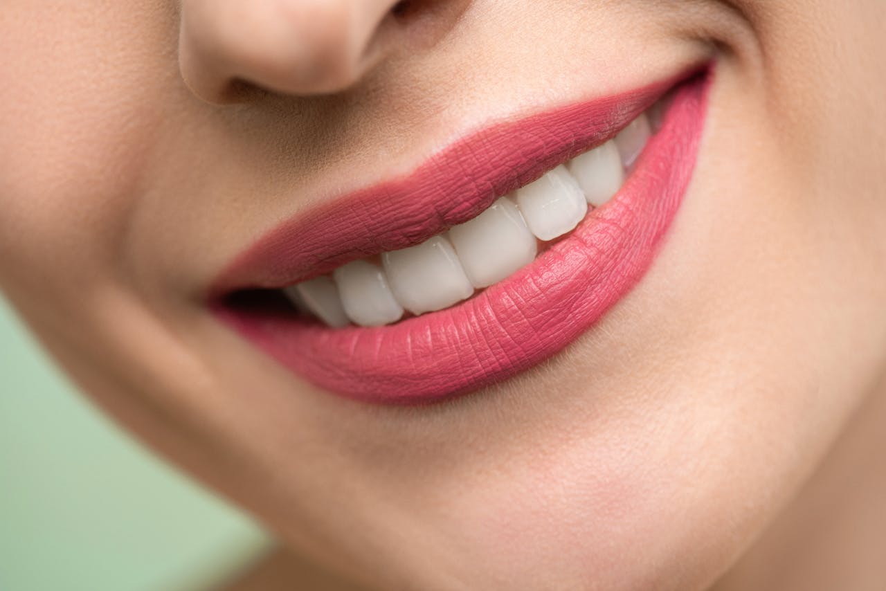 “Stralend Witte Tanden: Betaalbare Tanden Bleken in Roermond”
